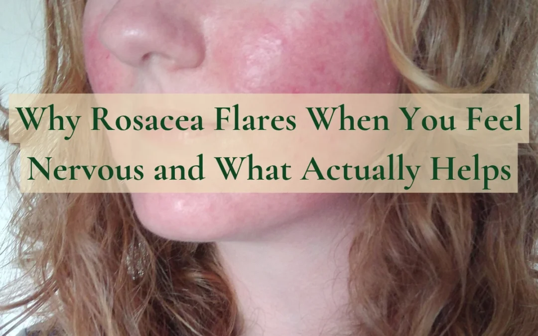 Why Rosacea Flares When You Feel Nervous and What Actually Helps