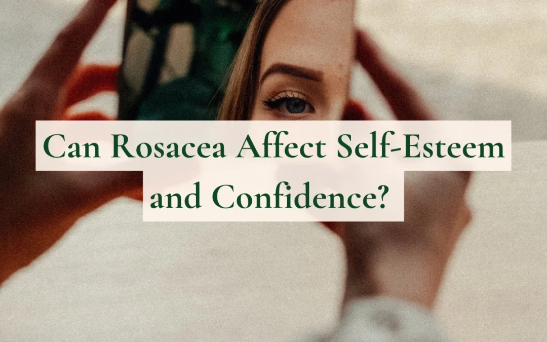 Can Rosacea Affect Self-Esteem and Confidence? (And What Actually Helps)