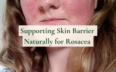 Supporting Skin Barrier Naturally for Rosacea with 3 Types of Omega Fatty Acids