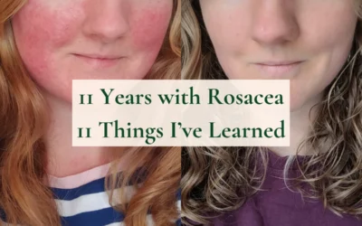 11 Years with Rosacea, 11 Things I’ve Learned